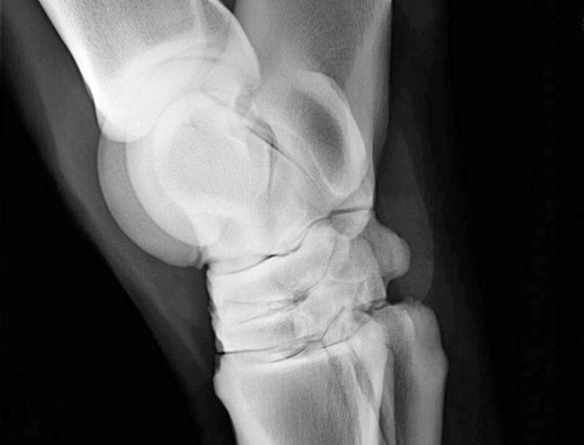 arthritis-x-ray