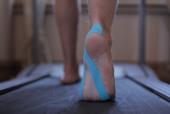 Kinesio taping on walking foot